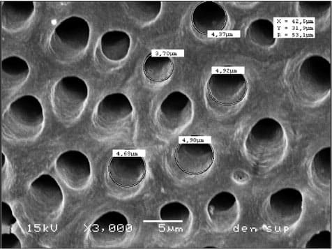 Dentin with dentinal tubules