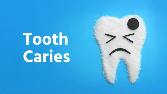 Cavities or tooth decay