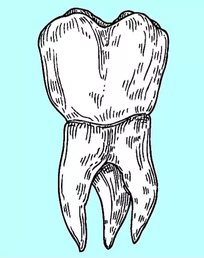 Molar tooth image