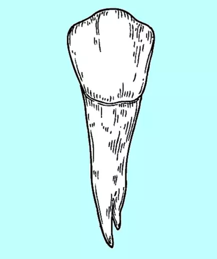 Premolar tooth image