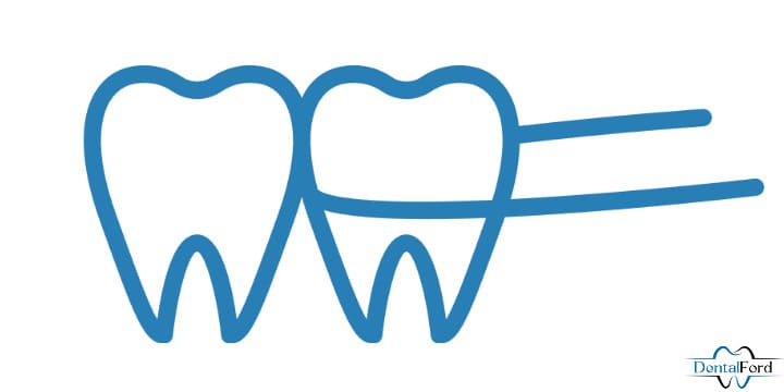 Floss around proximal surface of tooth like a C shape