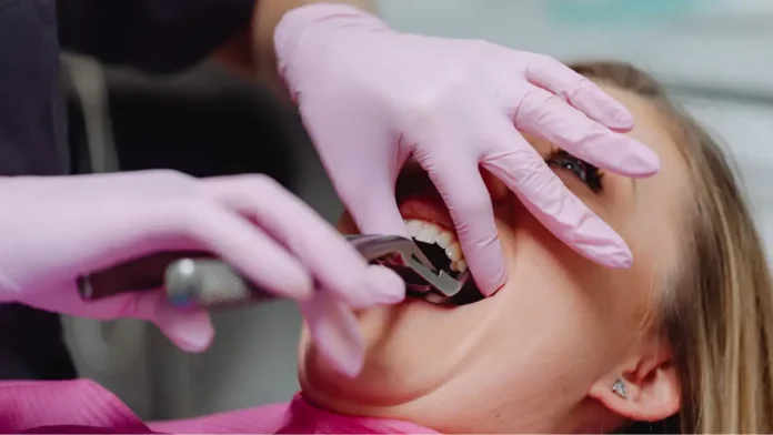 Tooth extraction